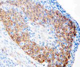 Anti-hCG receptor/LHCGR Antibody Picoband® Boster Bio
