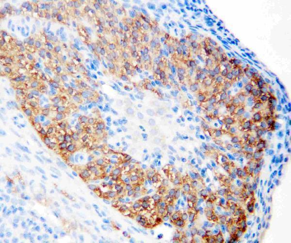 Anti-hCG receptor/LHCGR Antibody Picoband® Boster Bio