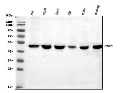 Anti-C-terminal-binding protein 2 CTBP2 Antibody Picoband® Boster Bio