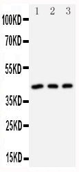 Anti-DAP Kinase 2/DAPK2 Antibody Picoband® Boster Bio