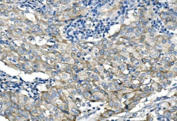 Anti-Desmoglein 2/DSG2 Antibody Picoband® Boster Bio