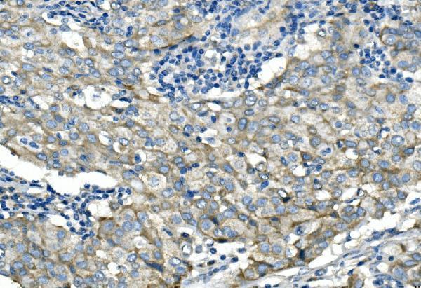 Anti-Desmoglein 2/DSG2 Antibody Picoband® Boster Bio