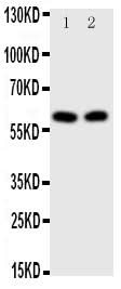 Anti-Transcription factor E2F1 E2F1 Antibody Picoband® Boster Bio