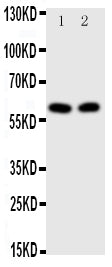 Anti-Transcription factor E2F1 E2F1 Antibody Picoband® Boster Bio