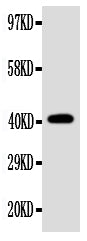 Anti-Ectodysplasin-A EDA Antibody Picoband® Boster Bio
