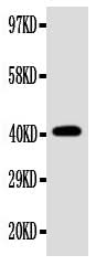 Anti-Ectodysplasin-A EDA Antibody Picoband® Boster Bio
