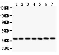 Anti-Leukemia inhibitory factor LIF Antibody Picoband® Boster Bio