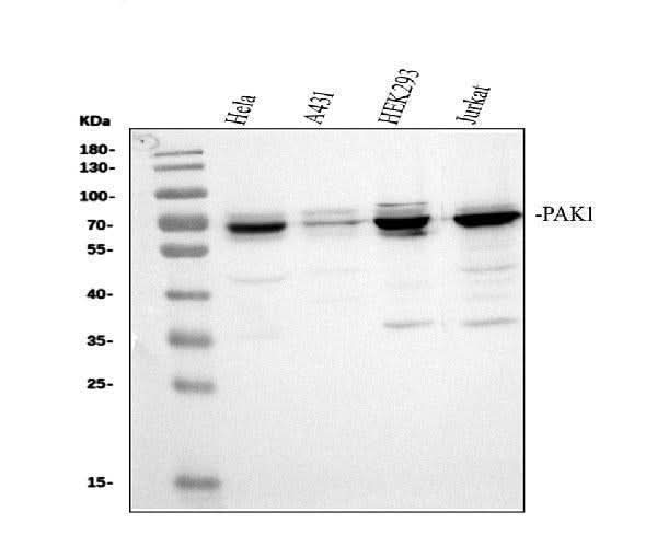 Anti-PAK1 Antibody Picoband® Boster Bio