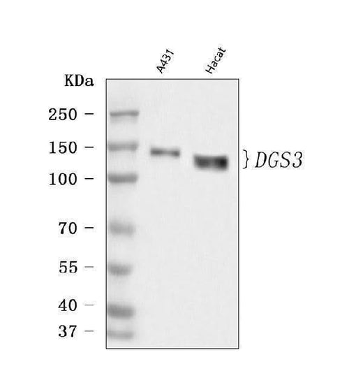 Anti-Desmoglein 3/DSG3 Antibody Picoband® Boster Bio