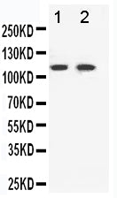 Anti-Eph receptor B3/EPHB3 Antibody Picoband® Boster Bio