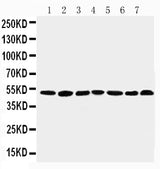 Anti-C-terminal-binding protein 1 CtBP1 Antibody Picoband® Boster Bio