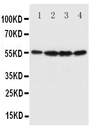 Anti-Fascin/FSCN1 Antibody Picoband® Boster Bio