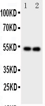 Anti-GABA A Receptor alpha 1/GABRA1 Antibody Picoband® Boster Bio