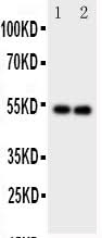Anti-GABA A Receptor alpha 1/GABRA1 Antibody Picoband® Boster Bio