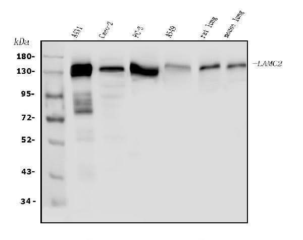 Anti-Laminin subunit gamma-2 LAMC2 Antibody Picoband® Boster Bio