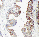 Anti-GST3/GST pi/GSTP1 Antibody Picoband® Boster Bio