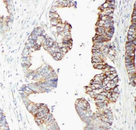 Anti-GST3/GST pi/GSTP1 Antibody Picoband® Boster Bio