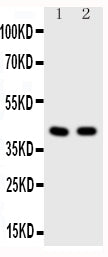 Anti-Histone deacetylase 8 HDAC8 Antibody Picoband® Boster Bio