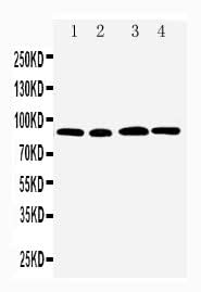 Anti-CD168/HMMR Antibody Picoband® Boster Bio