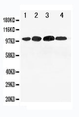 Anti-Mineralocorticoid Receptor/NR3C2 Antibody Picoband® Boster Bio