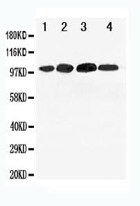 Anti-Mineralocorticoid Receptor/NR3C2 Antibody Picoband® Boster Bio
