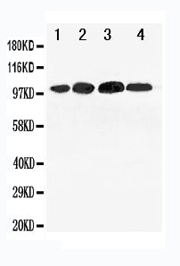 Anti-Mineralocorticoid Receptor/NR3C2 Antibody Picoband® Boster Bio