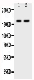 Anti-CD45/PTPRC Antibody Picoband® Boster Bio