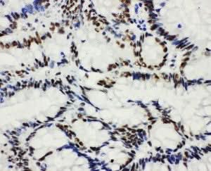 Anti-Histone deacetylase 3 HDAC3 Antibody Picoband® Boster Bio