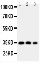 Anti-Homeobox protein Hox-A4 HOXA4 Antibody Picoband® Boster Bio