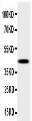 Anti-HSD17B2 Antibody Picoband® Boster Bio