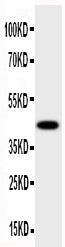 Anti-HSD17B2 Antibody Picoband® Boster Bio