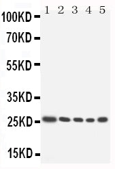 Anti-Homeobox protein Hox-A6 HOXA6 Antibody Picoband® Boster Bio