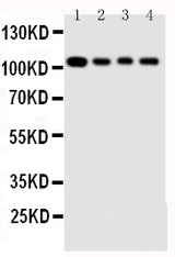 Anti-Hsp105/HSPH1 Antibody Picoband® Boster Bio