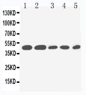 Anti-IL2 Receptor gamma/IL2RG Antibody Picoband® Boster Bio