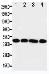 Anti-IL3RA Antibody Picoband® Boster Bio