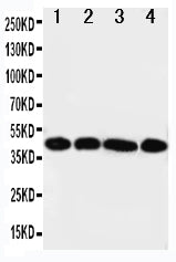 Anti-IL3RA Antibody Picoband® Boster Bio