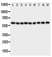 Anti-IL5RA Antibody Picoband® Boster Bio