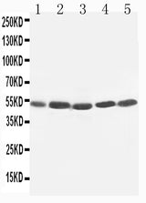 Anti-TIM 1/HAVCR1 Antibody Picoband® Boster Bio