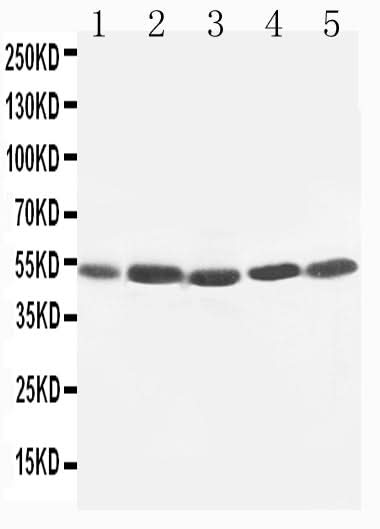 Anti-TIM 1/HAVCR1 Antibody Picoband® Boster Bio
