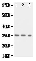 Anti-Kallikrein 1/KLK1 Antibody Picoband® Boster Bio