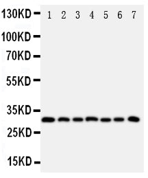 Anti-Kallikrein 11/KLK11 Antibody Picoband® Boster Bio