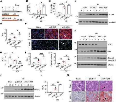 Anti-TIM 1/HAVCR1 Antibody Picoband® Boster Bio