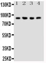 Anti-NRG2 Antibody Picoband® Boster Bio
