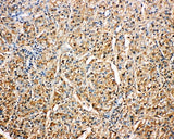 Anti-Kallistatin/SERPINA4 Antibody Picoband® Boster Bio