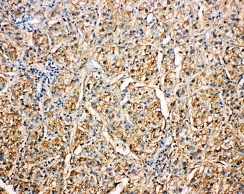 Anti-Kallistatin/SERPINA4 Antibody Picoband® Boster Bio