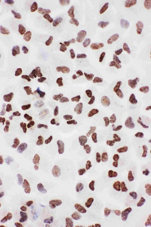 Anti-Ku70/XRCC6 Antibody Picoband® Boster Bio
