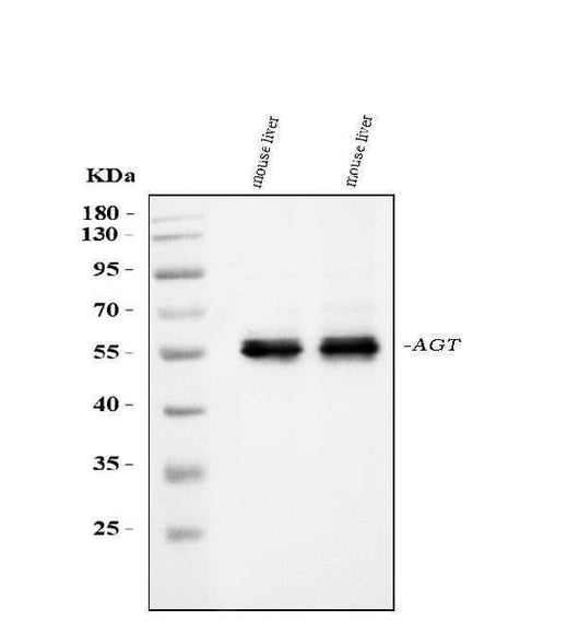 Anti-Angiotensinogen/AGT Antibody Picoband® Boster Bio