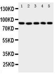 Anti-5 Lipoxygenase/ALOX5 Antibody Picoband® Boster Bio