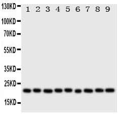 Anti-Cytoglobin/CYGB Antibody Picoband® Boster Bio