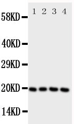 Anti-Lipocalin-1 LCN1 Antibody Picoband® Boster Bio